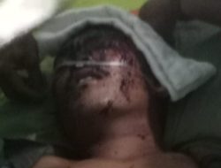 Tim Patroli BKSDA Di Terkam Harimau Sumatera