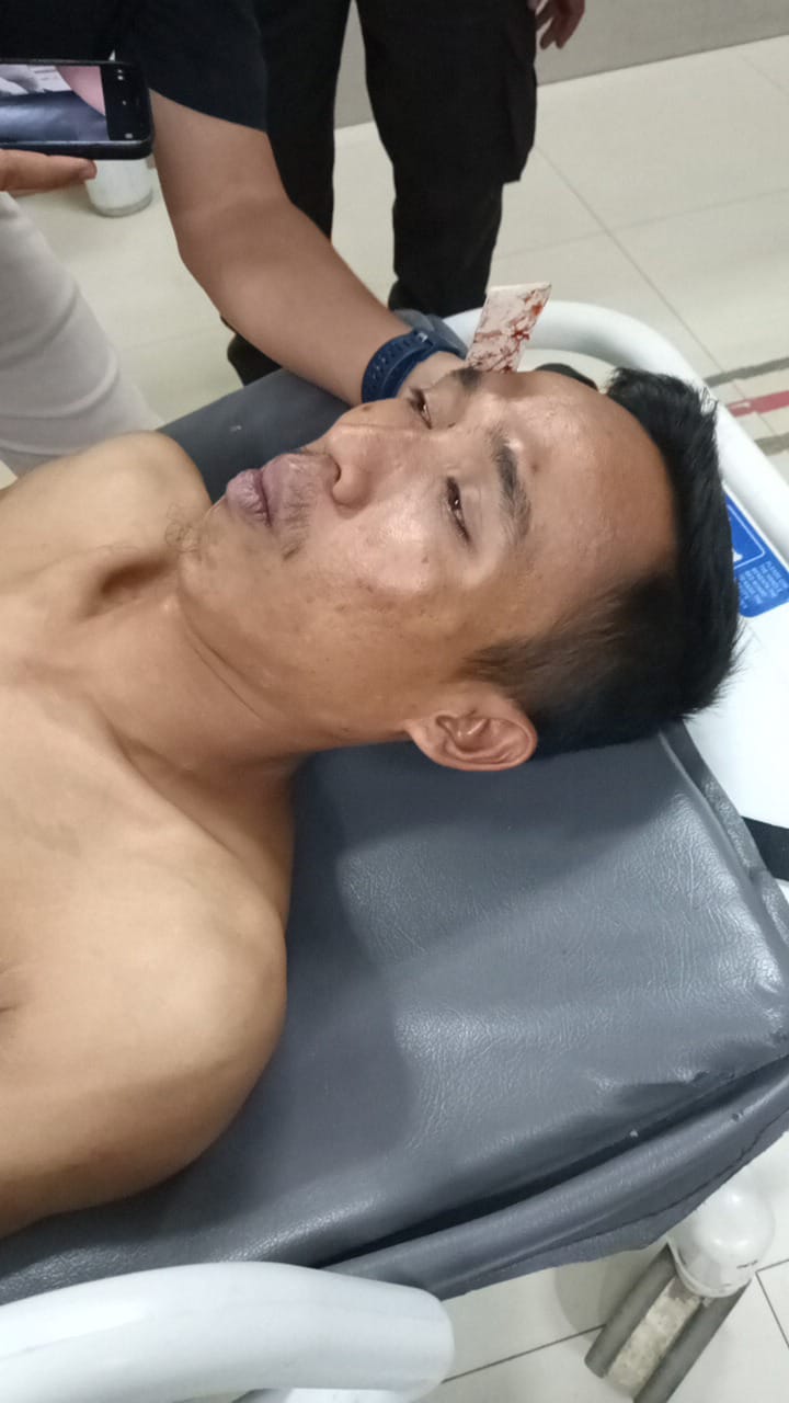 Hendak Jenguk Rekannya di RSUD Malimping, Seorang Warga Berinisial E jadi Korban Pengeroyokan Oleh Kelompok Orang Tak di Kenal.