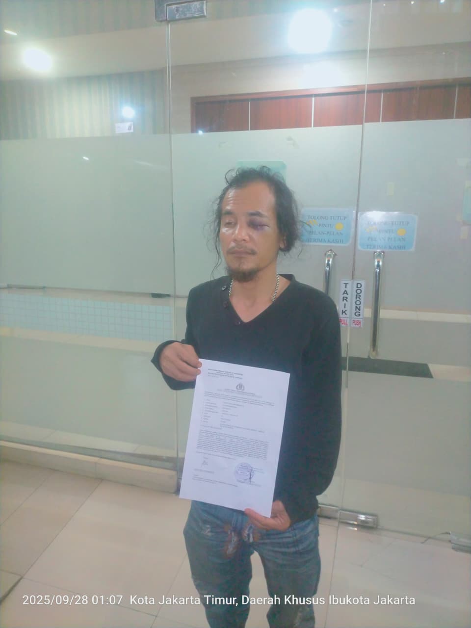 ‎AWIBB Kecam Keras!! Desak Polisi Tangkap Pelaku Pengeroyokan Wartawan di Mangun Jaya Tambun