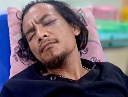 Ambarita Resmi Laporkan 10 Pelaku Tindak Kekerasan Terhadap Dirinya ke Polda Metro Jaya